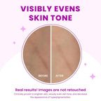 Lume Acidified Body Cream - Smooth Appearance of Rough. Bumpy Skin
